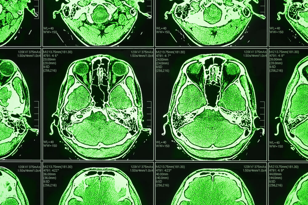 Image showing neurological scan with clear resolution EDIT