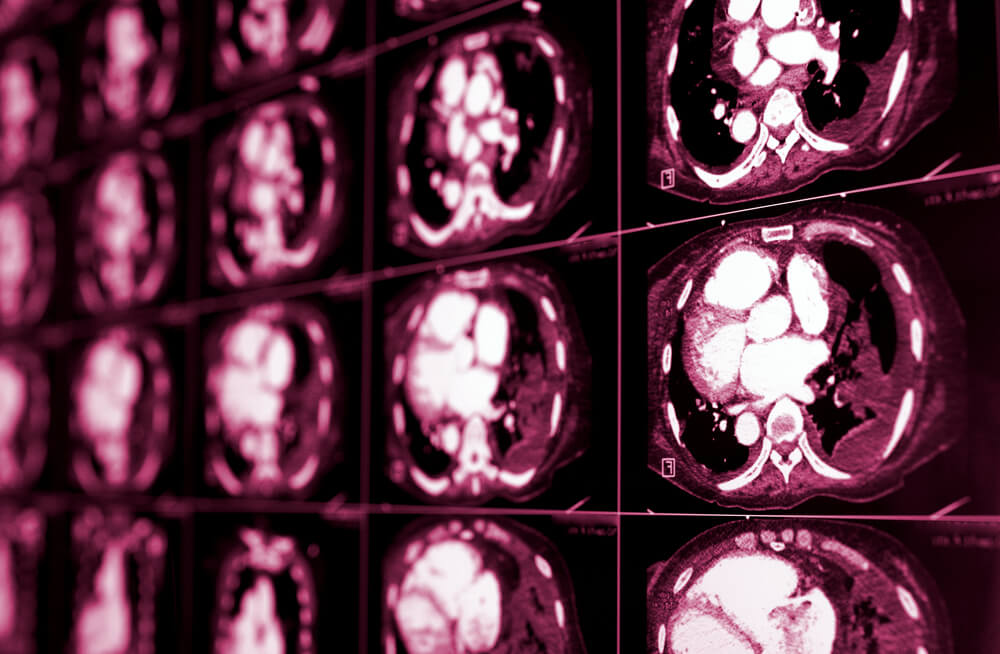 Medical Imaging picture
